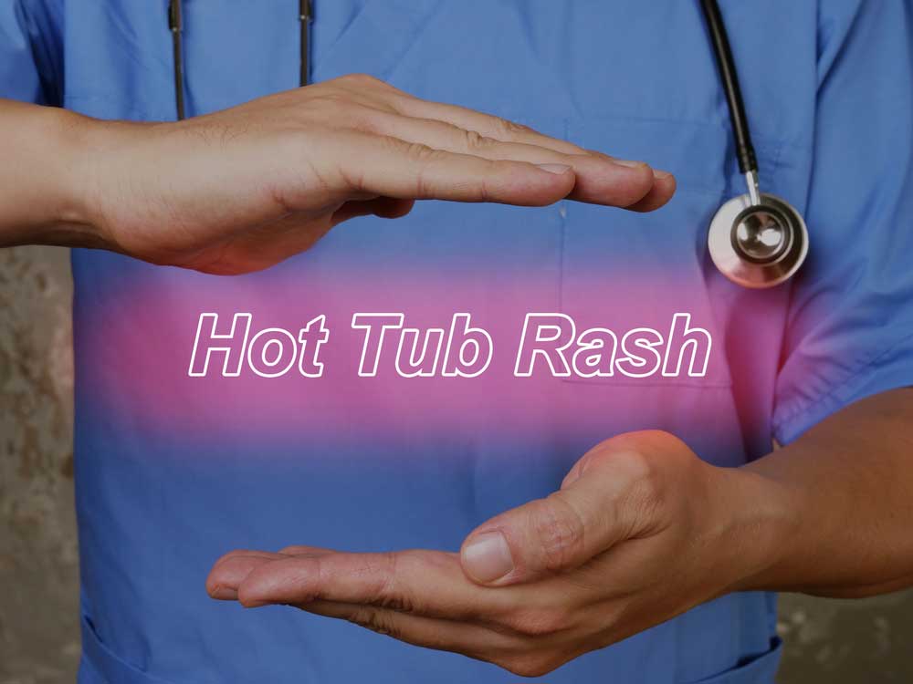 an image saying hot tub rash between two hands